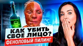 Что будет с лицом после фенолового пилинга? Побочные эффекты модной процедуры