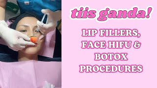 NAGPA-LIP FILLER, HIFU AT BOTOX AKO SA THE GLUTA LOUNGE!