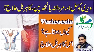 Vericocele Natural Treatment | Vericocele herbal treatment without surgery by herbalist Ali Azam