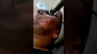 #skinlightening #skinbrightening #skinwhitening #shortvideo #ytshorts #shorts #viral #viralvideo