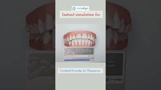 Invisalign INSTANT 3D Treatment Plan @ThanjaiDentalCentre