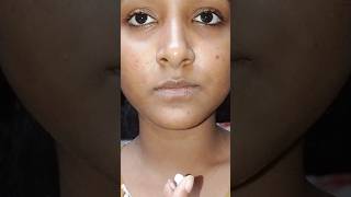 How to Cure Fever Blister | How to cure Jor thosa #Feverblister#jorthosa#skindisease