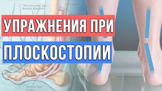 3 простых упражнения при плоскостопии