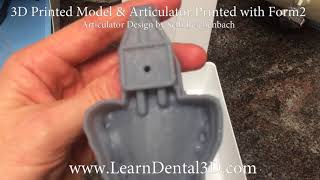 Simple 3D Printed Model & Articulator - No More Plaster!