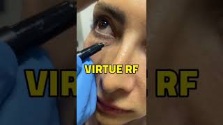 کاربردهای VIRTUE RF