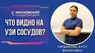 Что видно на УЗИ сосудов ?