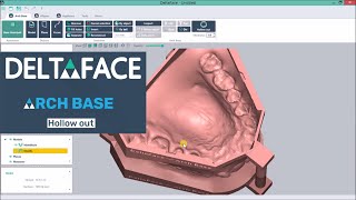 Dental model Hollow out