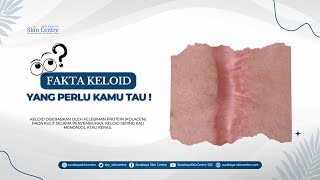 Bagaimana sihh Cara Menangani Keloid ?