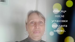 12. Имплантация/ Уже месяц, как установили имплант заново/ Мое состояние.