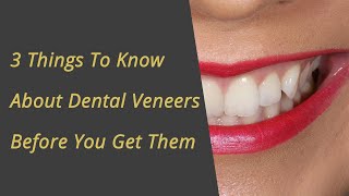 Top 3 things to know about Dental Veneers - Before you have them!