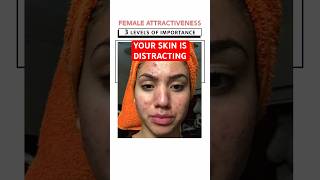 Your skin influences your attractiveness