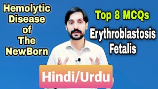 MCQs in Erythroblastosis Fetalis | Hindi/Urdu | Top 8 MCQs Hemolytic Disease of Newborn | MLT MCQs