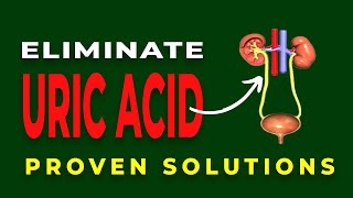 12 Remedies To Eliminate Uric Acid