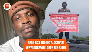 TEAR GAS TRAGEDY: ACTIVIST VERYDARKMAN LOSES HIS SIGHT