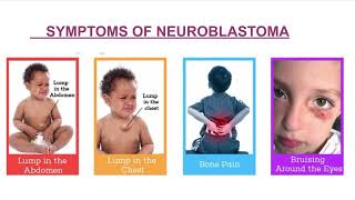 Neuroblastoma pathology mbbs