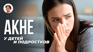 Как правильно лечить акне? Советы педиатра.