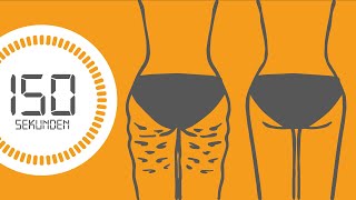 Kurzgefasst | Cellulite loswerden