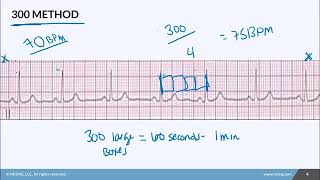 02.03 Calculating Heart Rate