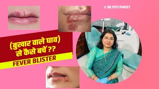 Fever Blister (बुखार वाले घाव) से कैसे बचें ??