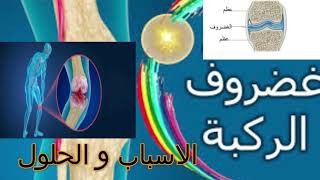 تآكل واحتكاك الغضروف#l arthrose# مرض العصر مهم نعرف السبب والحل باش نعيش هاني