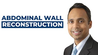 Abdominal Wall Reconstruction with Dr. Tushar Patel