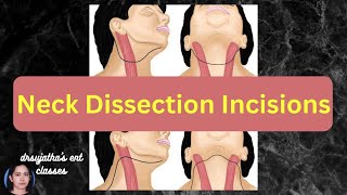 228.Incisions used for Neck Dissection #surgeryeducation #dentallectures