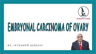 Embryonal Carcinoma of Ovary  | Female Genital Tract