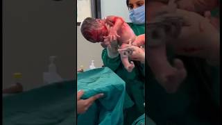 Baby Boy👶Operation Completed | Dr. Nikita Kalda | #shorts #firstshortvideo #youtubeshorts #doctor