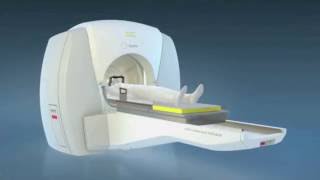 Gamma Knife, neuro-radiocirugía cerebral sin bisturí en Hospital San Javier