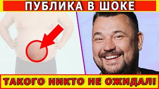 Шокирующие Подробности от Сергея Жукова! Сергей Жуков попал под нож и остался без пупка.