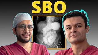 Ep 16: Mastering Bowel Obstruction Management: Essential Tips for Surgeons