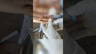 malaria test#viral#youtubeshorts#shorts#short#shortvideo#viralvideo#trending