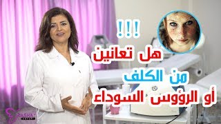 هل تعانين من الكلف أو النمش ؟ - سنتر رشا