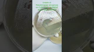 GROWTH OF PSEUDOMONAS AERUGINOSA ON CLED AGAR/ NUTRIENT AGAR/ MACCONKEY'S AGAR #shorts #microbiology