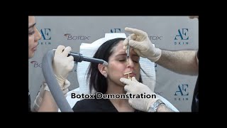 Botox Demonstration 22 Lips - 818-835-1833 - A E Skin - Encino, CA - 818-835-1833