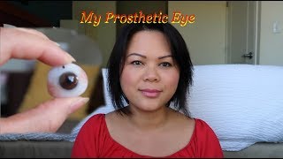 My Prosthetic Eye