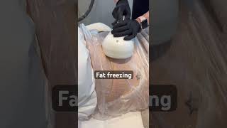 Struggling with stubborn fat? #medicalclinic #cryo #fatfreeze #bellyfat