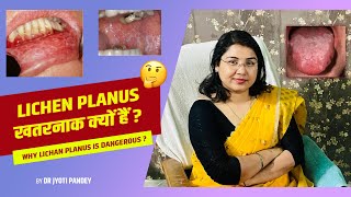 LICHEN PLANUS खतरनाक क्यों हैं ?