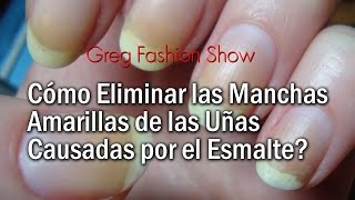 Cómo Eliminar Las Manchas Amarillas de las Uñas