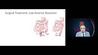 Gastroenterology Grand Rounds - Dr. Robert Bechara - October 21, 2021