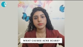 Acne Scar | What Causes Acne Scar | Treatment options | Cutis Skin Solution