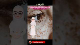 freckles treatment at home|jhaiyon ka ilaj||Free Ramedies