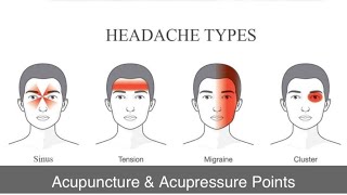 Acupuncture and acupressure point for headache