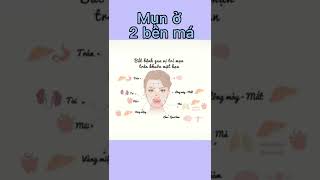 Vị trí mụn#short #skincare #authenticstore #đẹp #xinh #vị#trí#mụn#trán#mũi#miệng