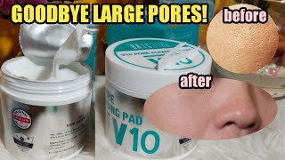 GOODBYE LARGE PORES NA BA? PAMPALIIT NG PORES Ft. BRTC V10 PORE CLEANSING PADS