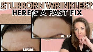 Is There a Way to Erase Wrinkles Quickly and Safely?