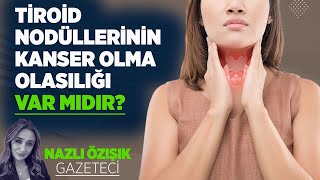 TİROİD NODÜLLERİNİN KANSER OLMA OLASILIĞI VAR MIDIR?