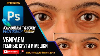 Простой способ убрать темные круги и мешки под глазами в Фотошопе. Face Retouch | Photoshop TV