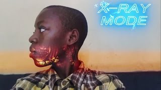 X RAY MODE l AFTER EFFECTS