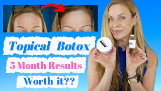 Topical Botox 5 Month Review! | Is it worth it? |  Dr. Hydrotox Review  | Mature Beauty